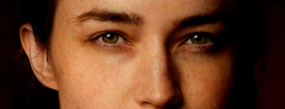 Eyes cured from Blepharitis